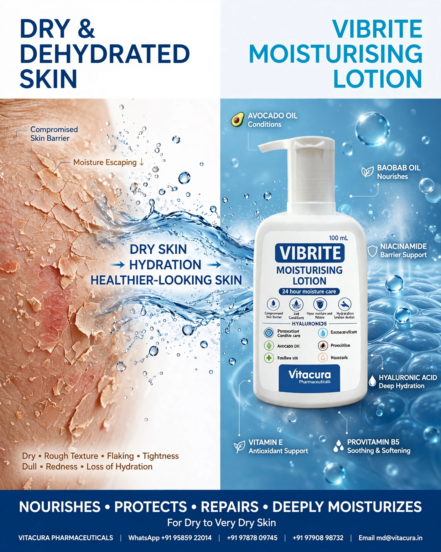 Vibrite Moisturising Lotion with Baobab Oil, Avocado Oil, Niacinamide, Vitamin E, Hyaluronic Acid & Panthenol | Deep Hydration & Skin Barrier Care | For Dry, Sensitive & Dehydrated Skin - Image 4